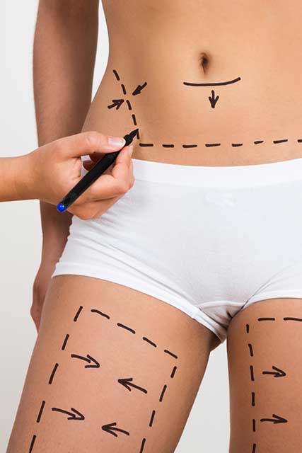 medicalbeautyspa-health-and-beauty-fett-absaugen-ohne-op3